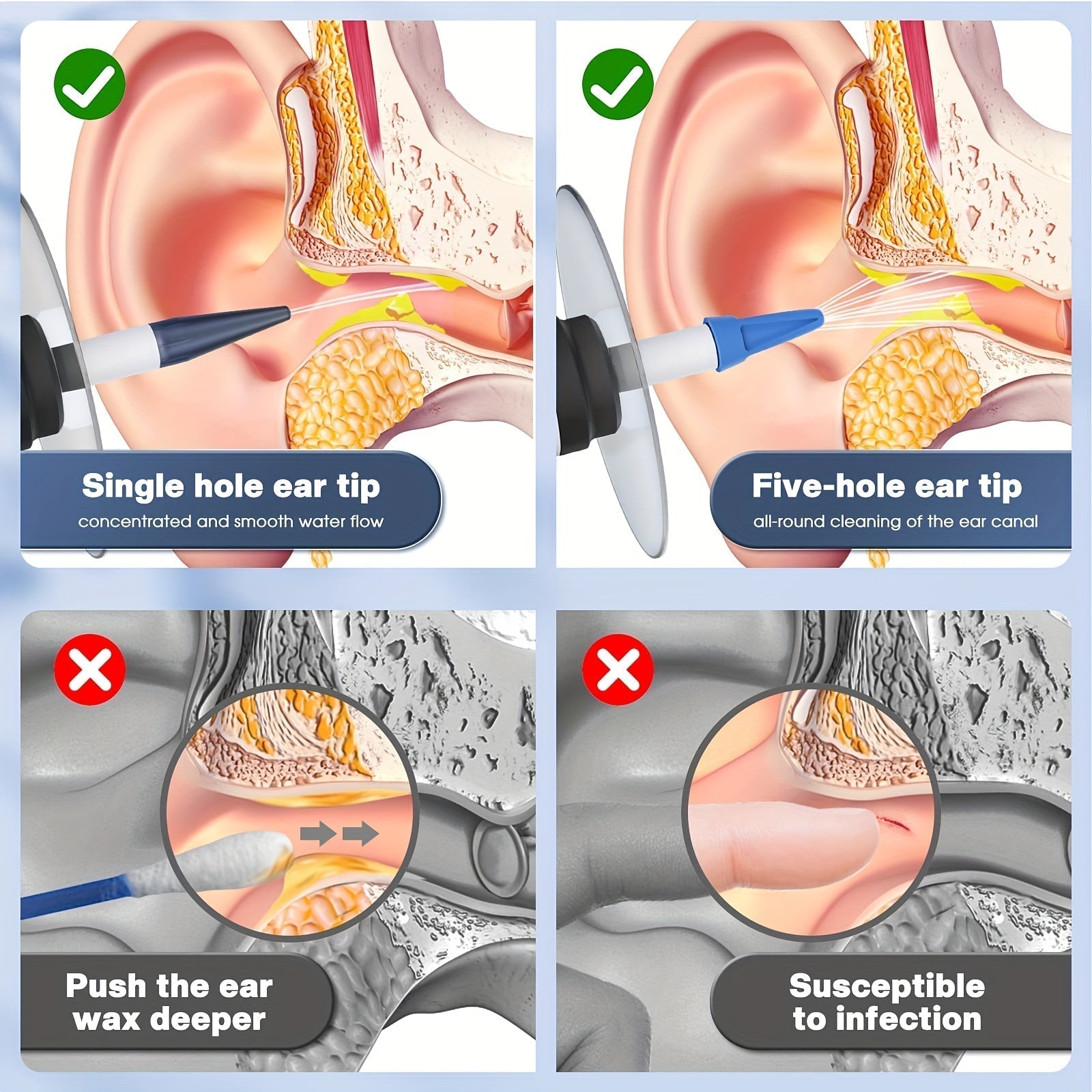 Set per la Pulizia Elettrica delle Orecchie – Sistema di Irrigazione Sicuro con Ugelli Monouso