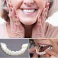 Veneers Smile (Including upper and lower arches)