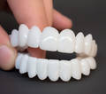Snap-On Όψεις Estetici | Κάλυψη για Ατέλειες του Χαμόγελου Άμεσα