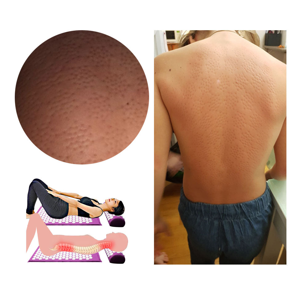 Set di Materasso e Cuscino per Agopressione – RelaxMat