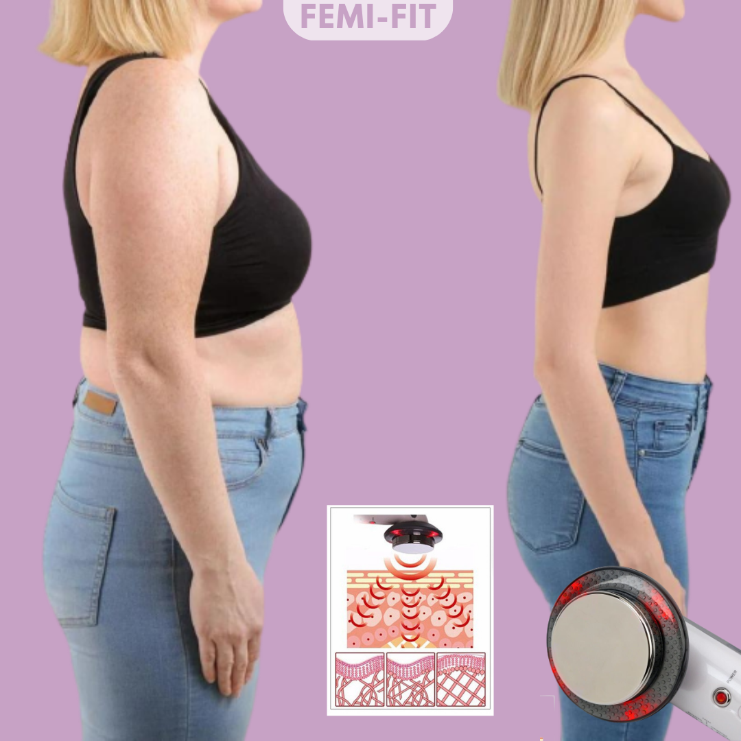 Rimuovi Grasso e Cellulite 3-in-1 – SlimShape