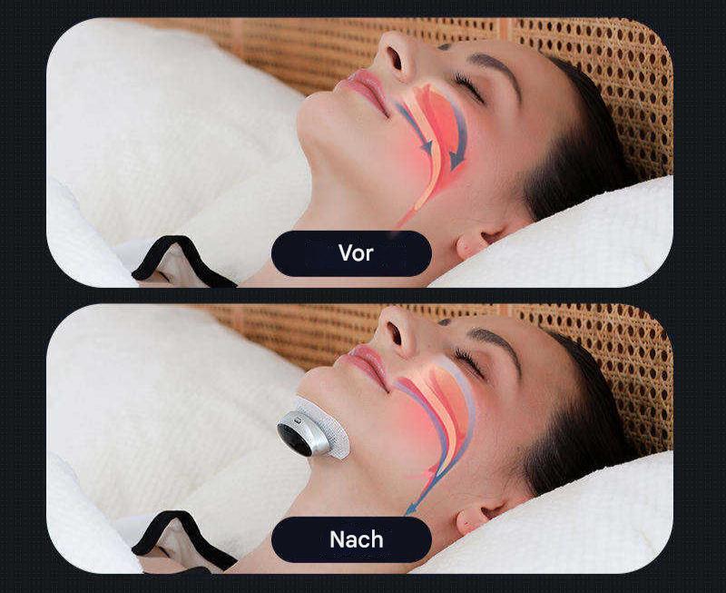 Dispositivo per Apnea Notturna - AirEase