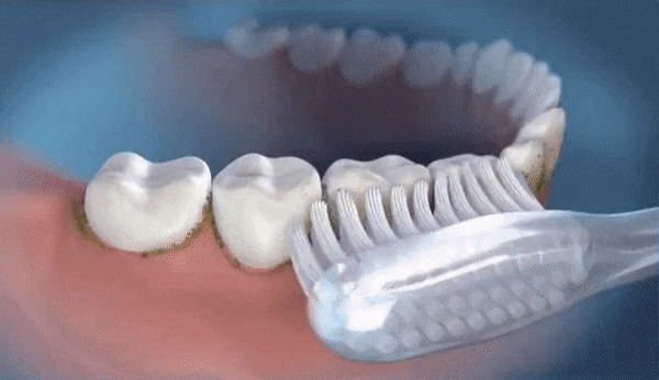 Waterflosser - Flossing senza dolore | Tre Opzioni di Colore