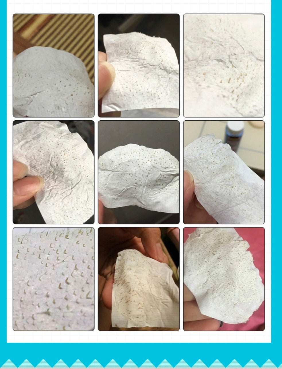 ClearSkin | Rimuovi Punti Neri