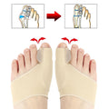 Correctors for Hallux Valgus Valgus